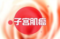 子宫肌瘤患者做试管助孕的饮食禁忌