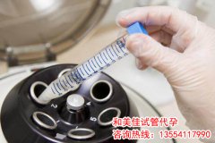 一般怎么选择冻胚移植的时间